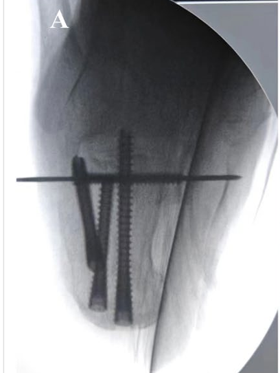 Fig. 3A