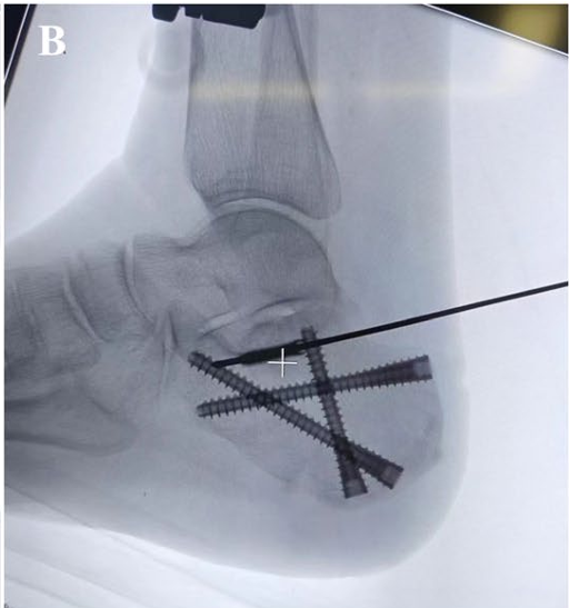 Fig. 3B