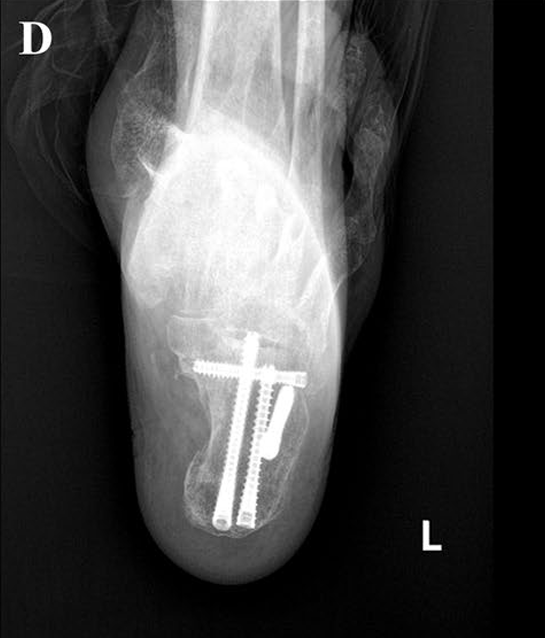 Fig. 3D