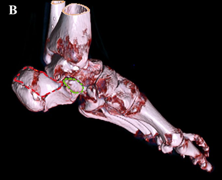 Fig. 1B