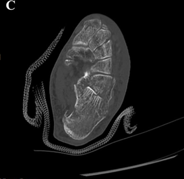 Fig. 1C