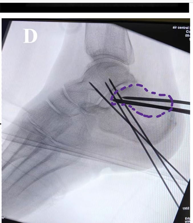 Fig. 2D