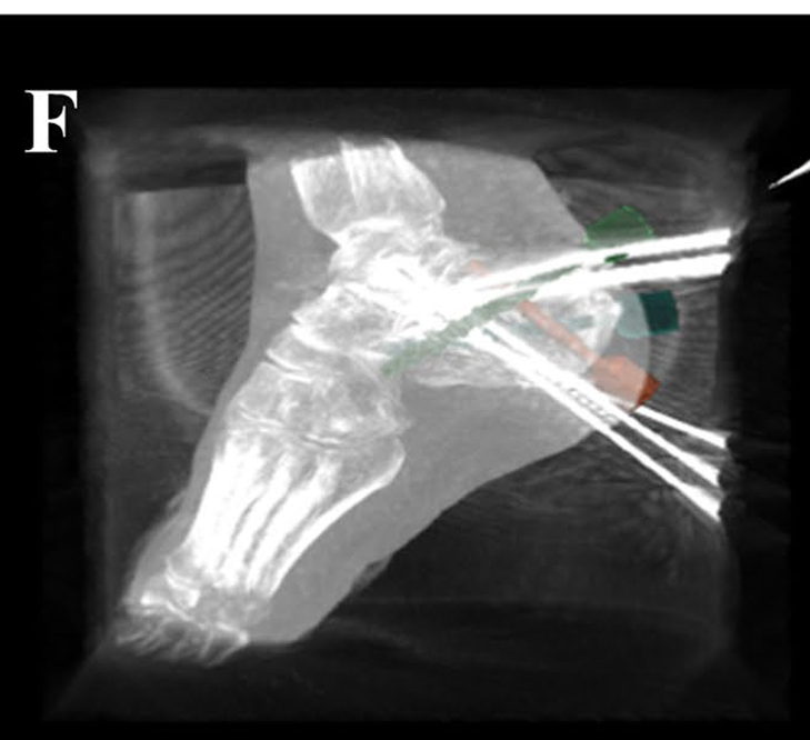 Fig. 2F